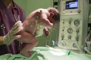 encefalopatía hipóxico-isquémica
