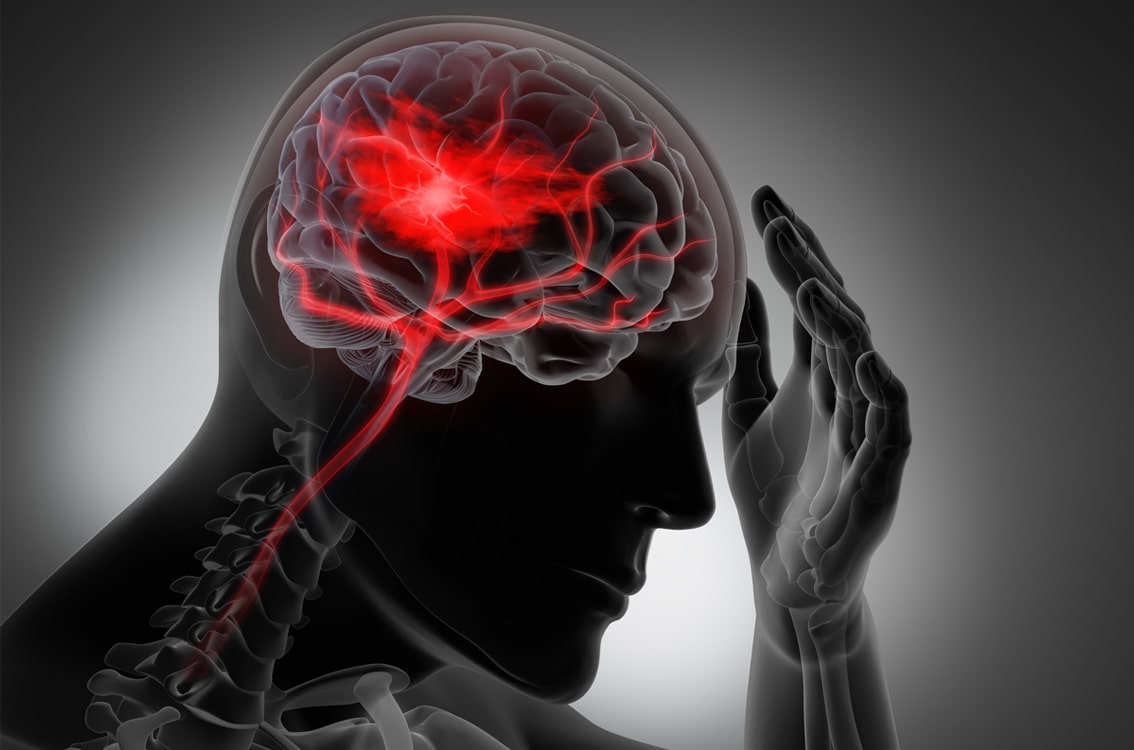 ictus-sintomas-min ictus-sintomas-min