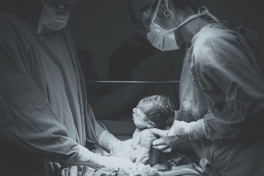 hipoxia o asfixia perinatal