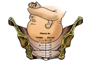 Plano hodge
