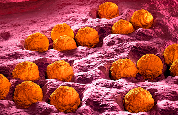 rubeola causa de hipoxia neonatal