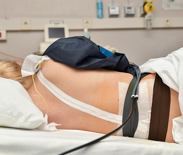 Uso de epidural durante el parto