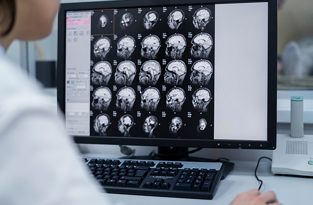 Hemorragia Intracraneal durante un Parto: Causas y Consecuencias