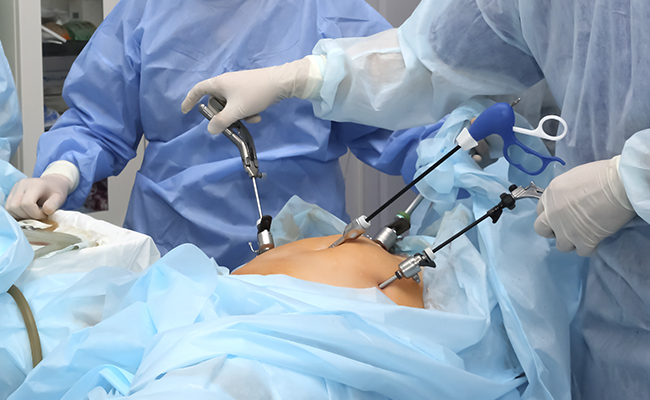 Hiperestimulación Uterina y Hemorragia Materna por Negligencia